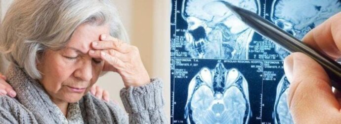 Άνοια: Η πασiγνωστη βιταμiνη που σώζει το μυαλό των 80ρηδων