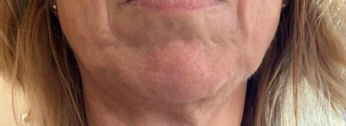 Ενδοκρινολόγος αποκαλύπτει τα δύο φαγητά που κάνουν το δέρμα να γερνά πιο γρήγορα