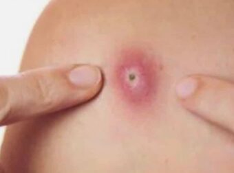 Προσοχή!! Αυτά είναι ξεκάθαρα σημάδια ότι αυτό είναι…