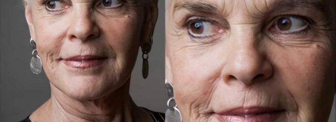 Κάποτε ήταν η πιο όμορφη γυναίκα του Χόλιγουντ, αλλά τώρα δεν τη γνωρίζουμε πια – Ποια είναι