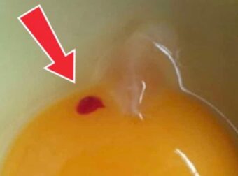 Πρέπει να τρώμε αυγά με κηλίδες αίματος;