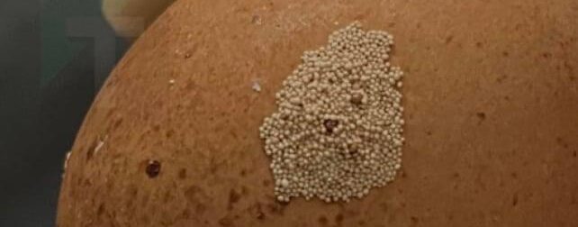 Μήπως γνωρίζει κάποιος τι μπορεί να είναι αυτά πάνω στα αυγά;