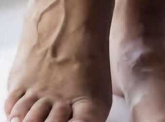 5 συμπτώματα στις γυναίκες που δείχνουν ότι έρχεται καρδιακή προσβολή