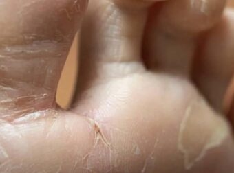 7 συμπτώματα που μπορεί να υποδηλώνουν σοβαρά προβλήματα υγείας