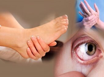 Σκλήρυνση κατά πλάκας (ΣΚΠ): Αuτά είναι τα Πρώιμα συμπτώματα