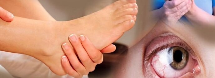 Σκλήρυνση κατά πλάκας (ΣΚΠ): Αuτά είναι τα Πρώιμα συμπτώματα