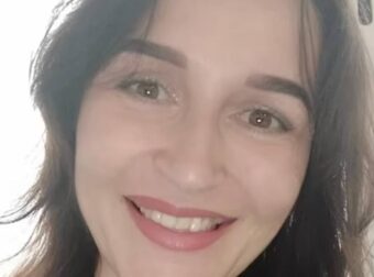 Φρίκη: 33χρονος «σταύρωσε» και έβαλε φωτιά στη σύντροφό του γιατί του ζήτησε να χωρίσουν – Σοκάρει φωτογραφία με το καμένο πρόσωπο της