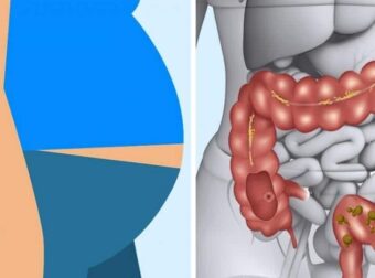 10 καθημερινά υγιεινά φαγητά που θα αποτοξινώσουν τον οργανισμό σας με φυσικό τρόπο