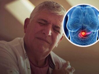 Καρκίνος στο Πάγκρεας: Δύο πρώιμα σημάδια ενός συχνά θανατηφόρου καρκίνου