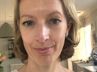 Γιατροί έμειναν άφωνοι: 45χρονη που υπέφερε από ίλιγγο και ζαλάδες βρήκε τη λύση με μια φυσική θεραπεία που της πρότειναν – Της άλλαξε τη ζωή