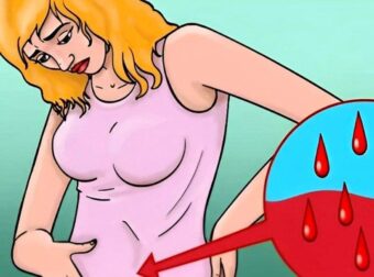 Η σχέση μεταξύ καρκίνου των ωοθηκών και του μαστού: Τι πρέπει να γνωρίζει κάθε γυναίκα