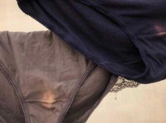 Όλα όσα πρέπει να ξέρετε για το υγρό που βγαίνει από