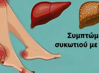 11 Σημάδια ότι το συκώτι σας δεν λειτουργεί σωστά και τοξίνες χτίζονται στο σώμα σας