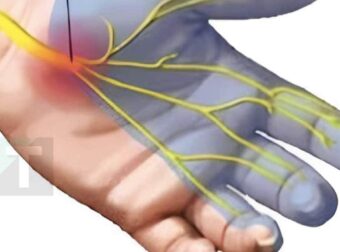 Αν έχετε μούδιασμα στα χέρια, μην αγνοήσετε αυτούς τους 7 λόγους