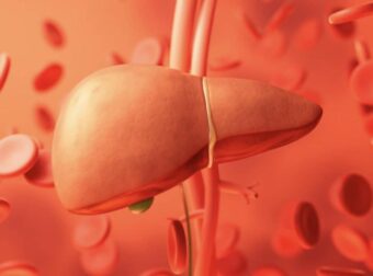 Λίπος στο συκώτι: Οι 4 χειρότερες τροφές για το λιπώδες ήπαρ, σύμφωνα με ηπατολόγο