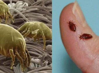 Ακάρεα, κοριοί, τσιμπούρια: Πως θα ξεχωρίσετε 9 διαφορετικά τσιμπήματα και τι πρέπει να κάνετε στο καθένα