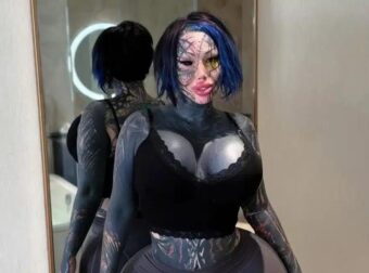 Εθισμένη στις πλαστικές επεμβάσεις 33χρονη έπεσε από τον 9ο όροφο ξενοδοχείου – Η μυστηριώδης τελευταία ανάρτησή της