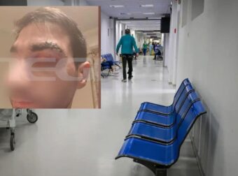 Αίγιο: Πέθανε ο 43χρονος ασθενής μποξέρ που γρονθοκόπησε γιατρό – Τι λέει ο ορθοπεδικός για την επίθεση