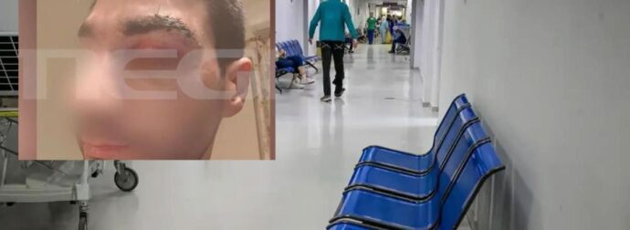 Αίγιο: Πέθανε ο 43χρονος ασθενής μποξέρ που γρονθοκόπησε γιατρό – Τι λέει ο ορθοπεδικός για την επίθεση