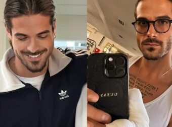 Άρης Μουγκοπέτρος: Δείχνει για πρώτη φορά τα δύο πρόσθετα δάχτυλα μετά τον ακρωτηριασμό του