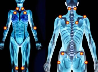 Ινομυαλγία: Η ύπουλη πάθηση που προκαλεί πόνο παντού – Πού οφείλεται και ποια είναι τα σημάδια