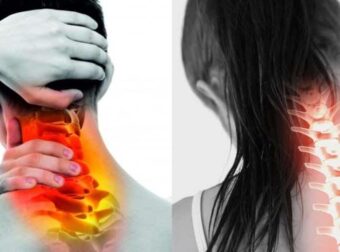 Πόνος στον αυχένα: 2 γιατροσόφια το μυστικό για άμεση ανακούφιση