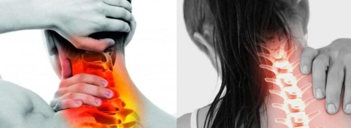 Πόνος στον αυχένα: 2 γιατροσόφια το μυστικό για άμεση ανακούφιση