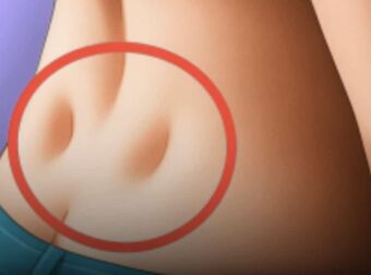Έχετε αυτά τα δύο μικρά λακκάκια στη βάση της πλάτης σας; Τι αποκαλύπτουν