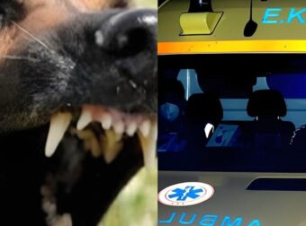 Της επιτέθηκε σκύλος και της έκοψε δύο δάχτυλα – Νύχτα τρόμου ανήμερα τα Χριστούγεννα