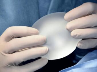 30χρονη Ελληνίδα μητέρα πήγε σε πασίγνωστο πλαστικό στην Αθήνα να φτιάξει το στήθος της και της το έκανε τετράγωνο