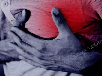 Ένα μήνα πριν το έμφραγμα το σώμα σου θα σου στείλει αυτά τα 9 σημάδια – Μην τα αγνοήσεις