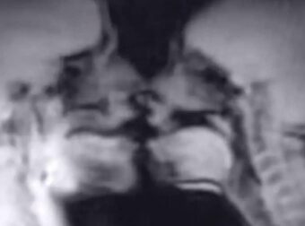 Δείτε τι έκαναν μέσα σε μαγνητικό τομογράφο και κατέληξαν σε επιστημονική ανακάλυψη