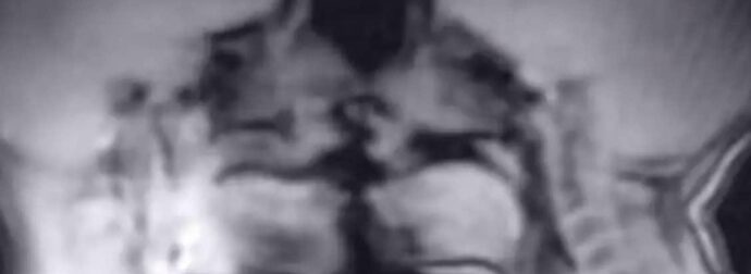 Δείτε τι έκαναν μέσα σε μαγνητικό τομογράφο και κατέληξαν σε επιστημονική ανακάλυψη