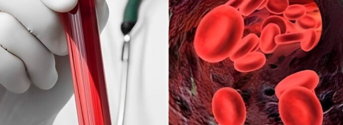 Αιματοκρίτης: Οι φυσιολογικές τıμές ανά ηλικία – Τι πρέπει να τρώτε για να τον αuξńσετε