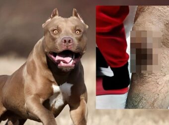 Σοκ στην Ομόνοια με πίτμπουλ – «Το σκυλί με δάγκωνε και αυτός με χτυπούσε»