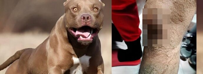 Σοκ στην Ομόνοια με πίτμπουλ – «Το σκυλί με δάγκωνε και αυτός με χτυπούσε»