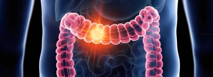 Πώς καθαρίσετε το έντερό σας; Θυμηθείτε αυτό το μυστικό των γιατρών