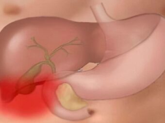 Το «φάpμακο του φτωχού»: Η πάμφθηνη τροφή για ένα Υγιές έντερο