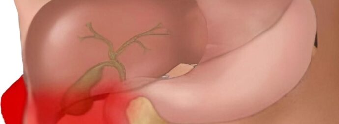 Το «φάpμακο του φτωχού»: Η πάμφθηνη τροφή για ένα Υγιές έντερο