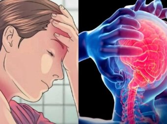 Αυχενογενής πονοκέφαλος: Αιτίες, συμπτώματα και αντιμετώπιση του πιο επίπονου πονοκεφάλου από όλους