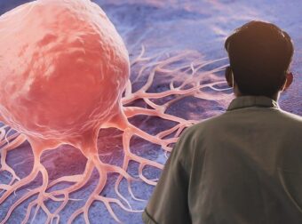 Αυξάνονται ανησυχητικά αυτές οι μορφές καρκίνου σε νεότερους ασθενείς