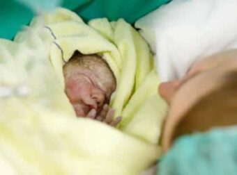 18χρονη έγκυος γέννησε μετά από 4 ώρες τοκετού – Μόλις οι γιατροί είδαν το στόμα του μωρού έπαθαν σοκ