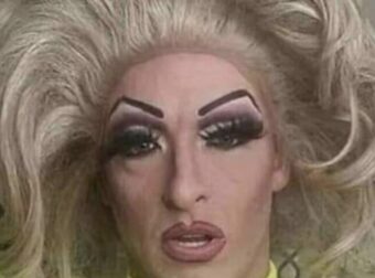 Άντρας πέθανε μετά από σeξ με σκúλο – Η αιτία θανάτου σοκάpει