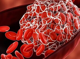 8 θρεπτικά συστατικά που χρειάζεστε για να διαλύσετε τους θρόμβους αίματος τώρα