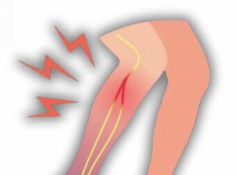 5 απροσδόκητες αιτίες αδυναμίας στα πόδια σε ηλικιωμένους και πώς να τις διορθώσετε