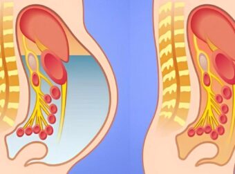Φυσικοί λιποδιαλύτες: 8 τροφές για αποτοξίνωση στο συκώτι και γρήγορη απώλεια βάρους