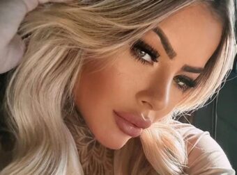 Νεκρή η 27χρονη Μπιάνκα Ντίας μετά από επιπλοκές αισθητικής επέμβασης