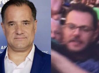 Άδωνις Γεωργιάδης: «Ο "καλός" και "αδικημένος" γιατρός από τη Νίκαια ήθελε απόδειξη ότι με κτύπησε, δείτε τη γροθιά του»