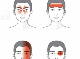 Έτσι αποκαλύπτουν οι πονοκέφαλοι τι δεν πάει καλά με την υγεία σας