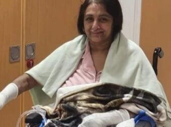 Γυναίκα έχασε όλα τα άκρα της, έπαθε σηψαιμία από σκύλο που της έγλειψε μια πληγή